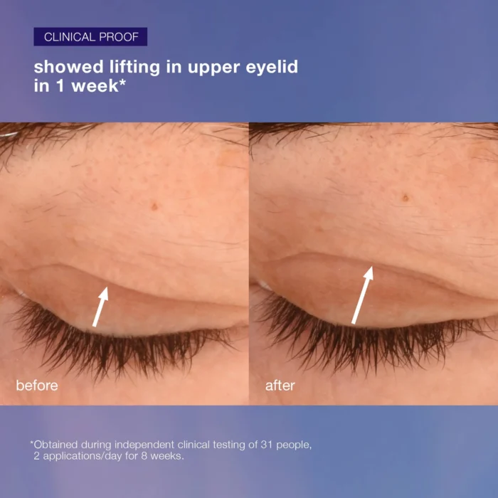 phyto nature lift eye cream - Image 4