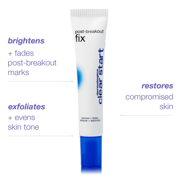 cs post breakout fix - Image 1
